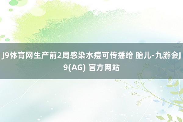 J9体育网生产前2周感染水痘可传播给 胎儿-九游会J9(AG) 官方网站